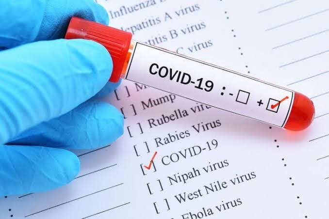 Fake Coronavirus results are sold to international travellers
